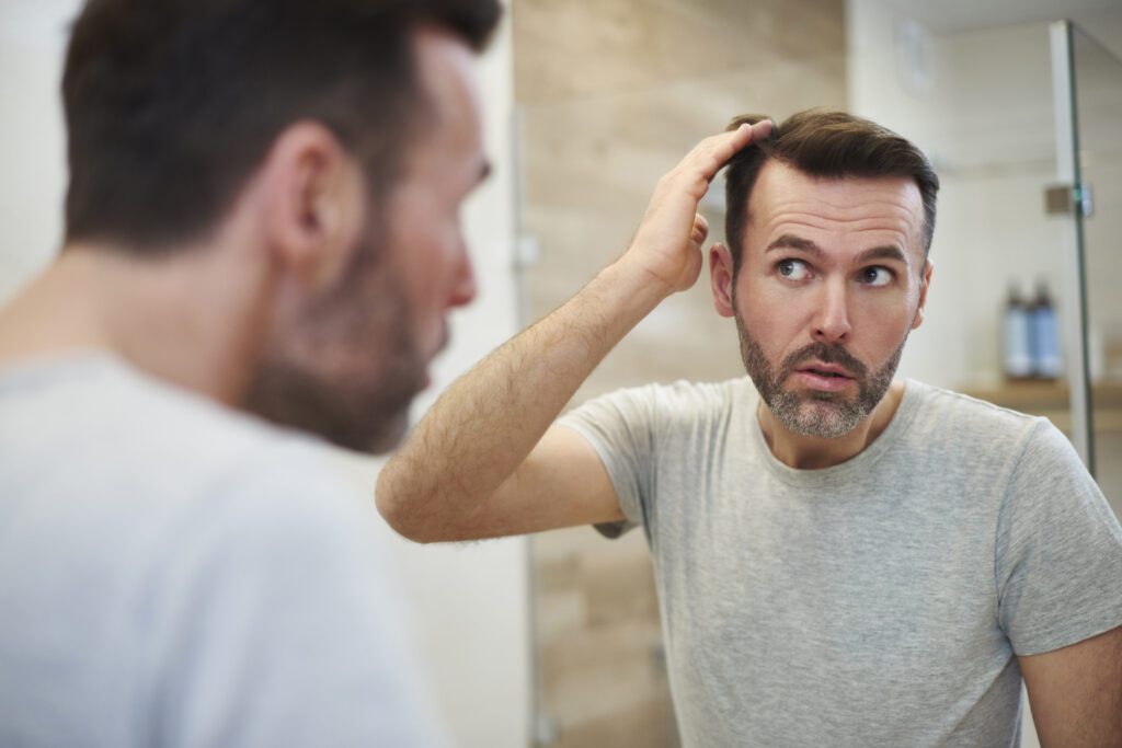 A alopecia é um termo médico utilizado para descrever a perda de cabelo.